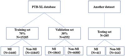 Acute Myocardial Infarction Detection Using Deep Learning-Enabled Electrocardiograms